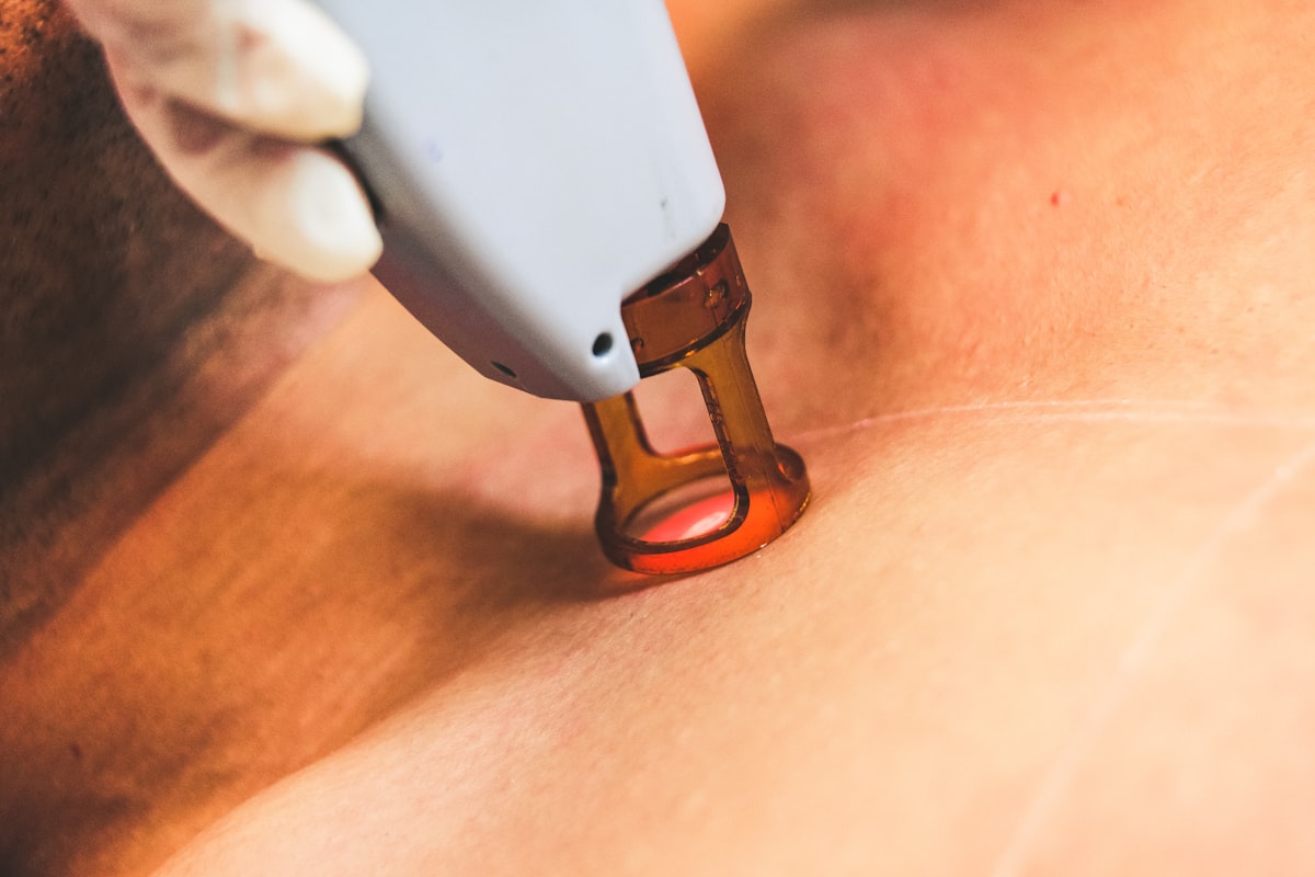 Benefícios dos Procedimentos Dermatológicos